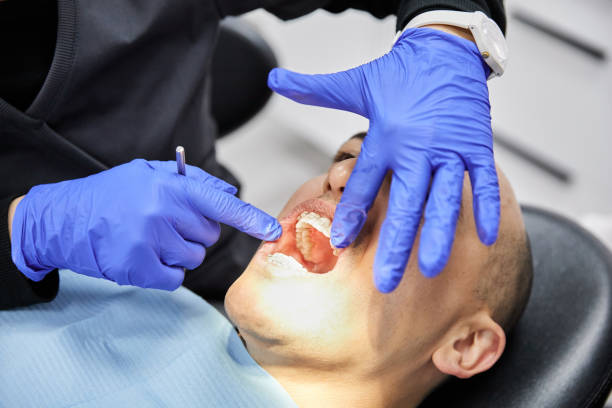 Best Emergency Dental Care for Abscessed Tooth in Lake Bryan, TX
